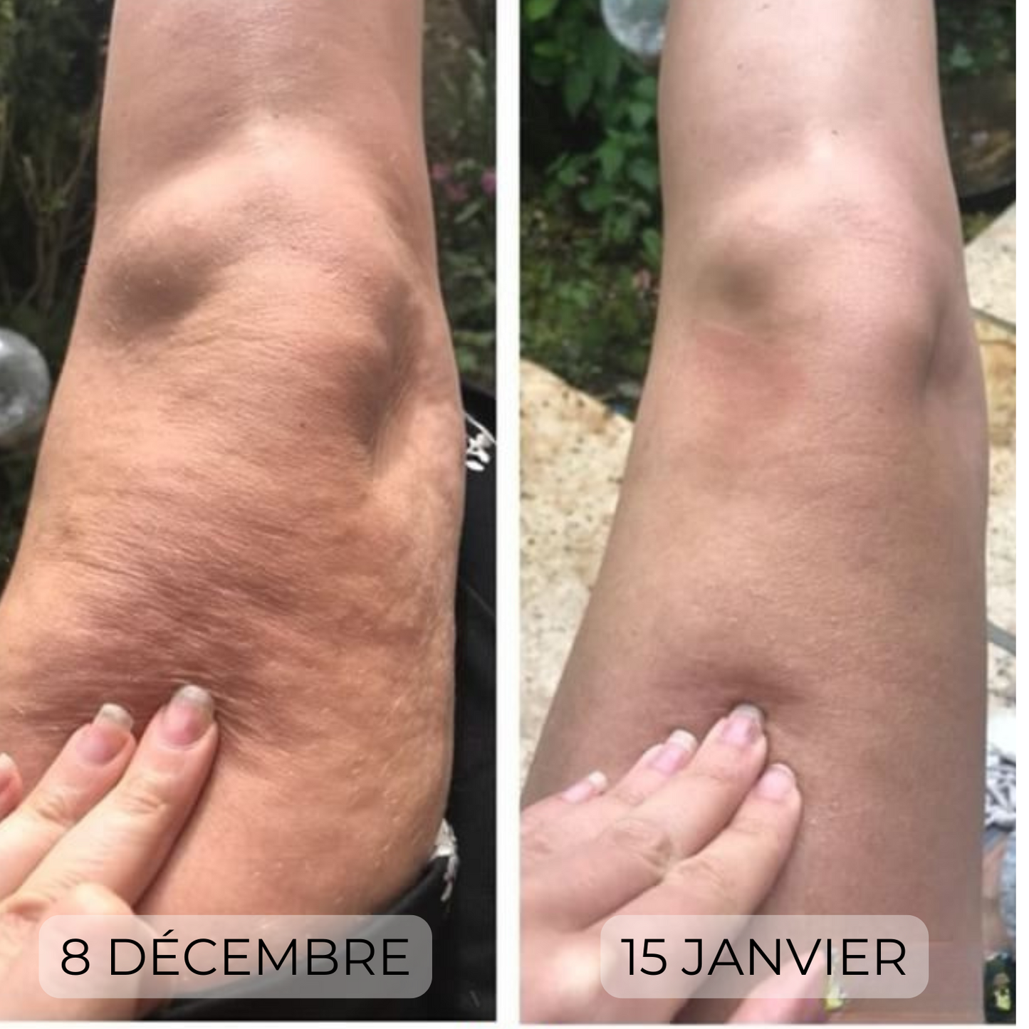 Legging Anti-Cellulite 3D