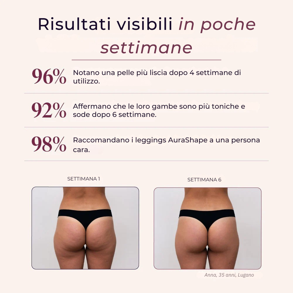 3D Anti-Cellulite Leggings